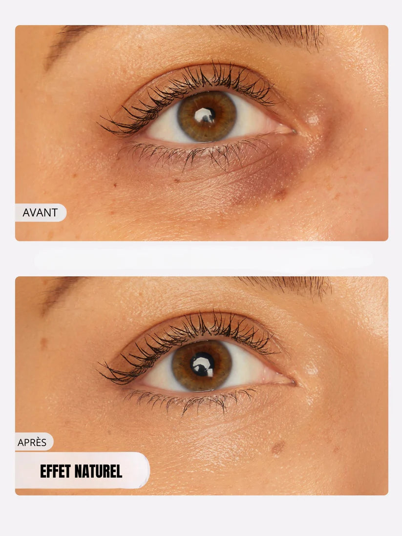 Eye contour corrector