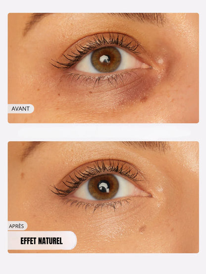 Eye contour corrector